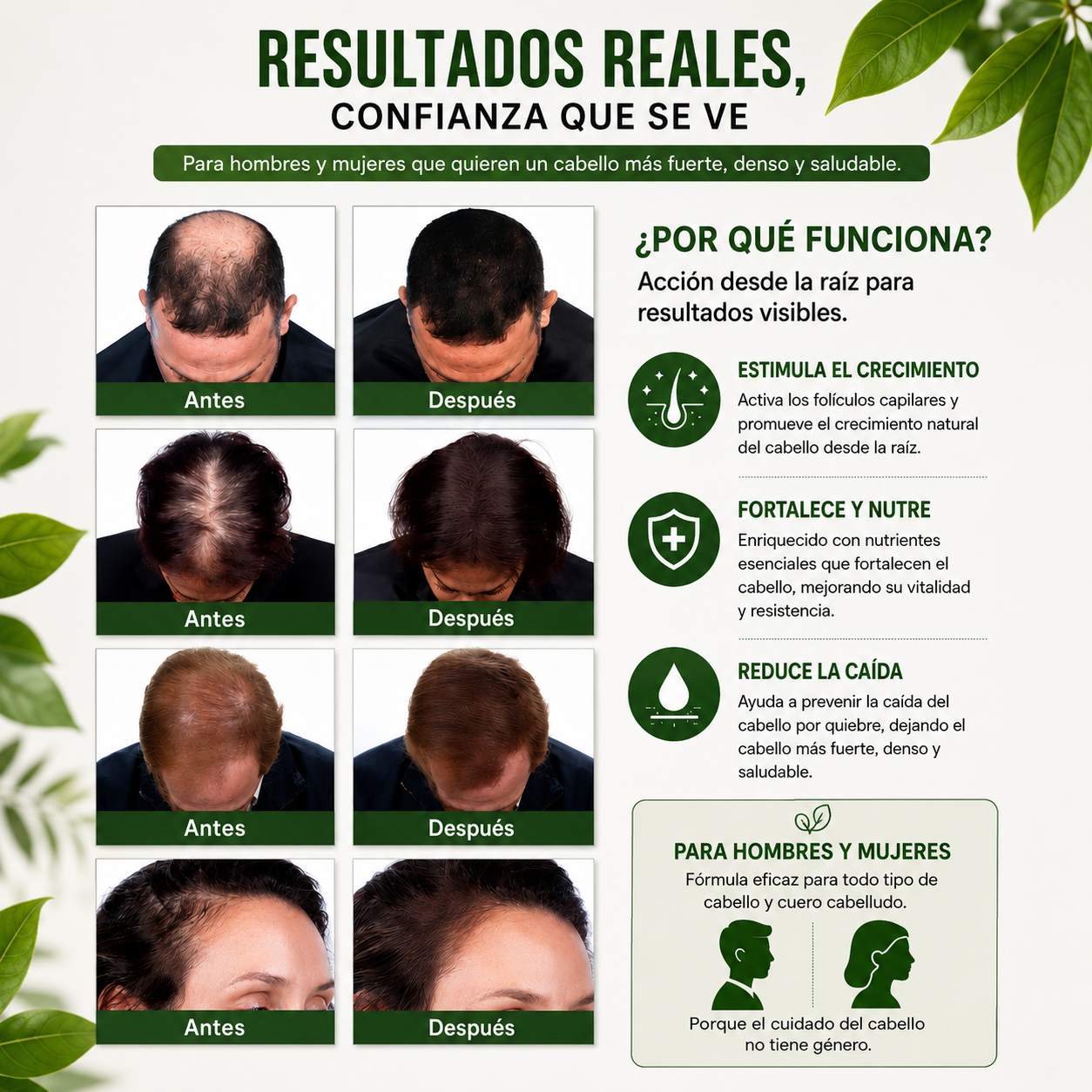 SPRAY DE CRECIMIENTO DEL CABELLO INTENSIVO